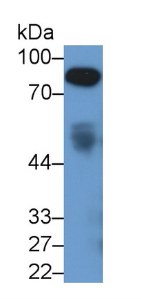 Monoclonal Antibody to Afamin (AFM)