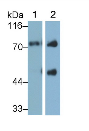 Monoclonal Antibody to Afamin (AFM)