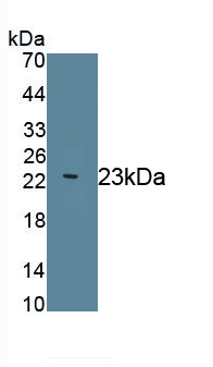 Monoclonal Antibody to Mesencephalic Astrocyte Derived Neurotrophic Factor (MANF)