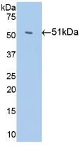 Monoclonal Antibody to Antithrombin (AT)