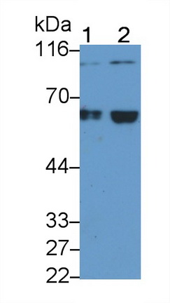 Monoclonal Antibody to Antithrombin (AT)