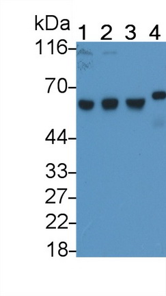 Monoclonal Antibody to Antithrombin (AT)