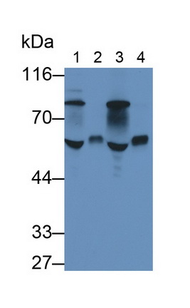 Monoclonal Antibody to Antithrombin (AT)