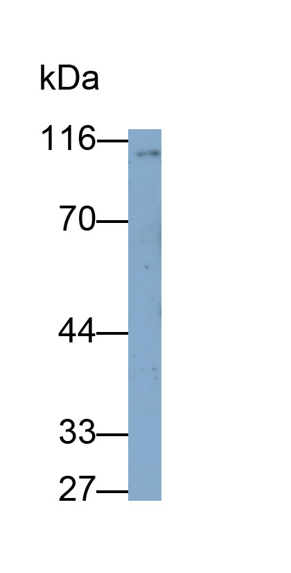 Monoclonal Antibody to Ectonucleotide Pyrophosphatase/Phosphodiesterase 2 (ENPP2)