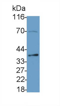 Monoclonal Antibody to Caspase 6 (CASP6)