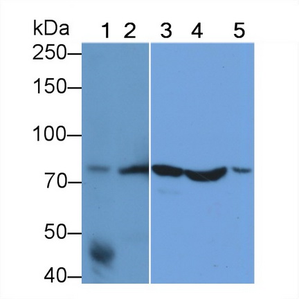 Monoclonal Antibody to Heat Shock 70kDa Protein 5 (HSPA5)