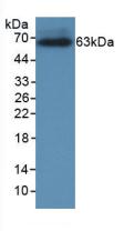 Monoclonal Antibody to Corticotropin Releasing Hormone Binding Protein (CRHBP)