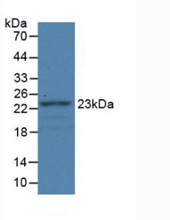 Monoclonal Antibody to Fibulin 1 (FBLN1)