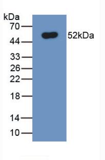 Monoclonal Antibody to Ferroportin (FPN)