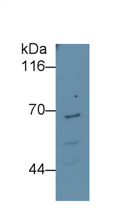 Monoclonal Antibody to Ferroportin (FPN)