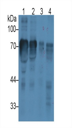 Monoclonal Antibody to Histidine Rich Glycoprotein (HRG)