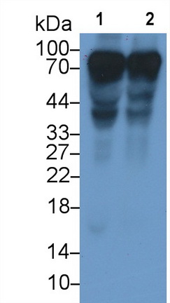 Monoclonal Antibody to Histidine Rich Glycoprotein (HRG)