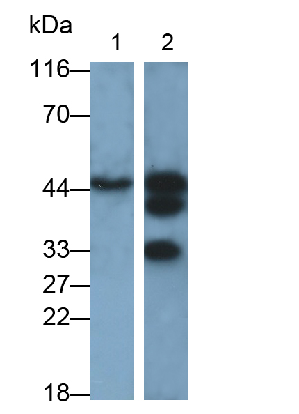 Monoclonal Antibody to Pim-1 Oncogene (PIM1)