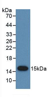 Monoclonal Antibody to Prostate Stem Cell Antigen (PSCA)