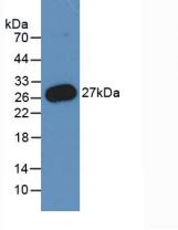 Monoclonal Antibody to Peripheral Myelin Protein 22 (PMP22)