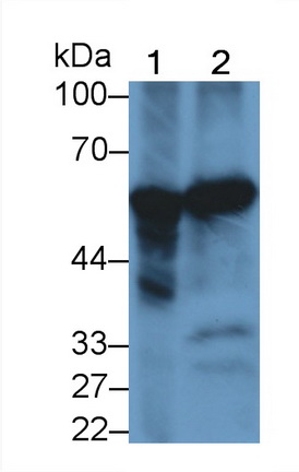 Monoclonal Antibody to Phenylalanine Hydroxylase (PAH)