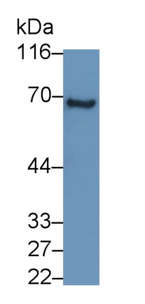 Monoclonal Antibody to Prosaposin (PSAP)