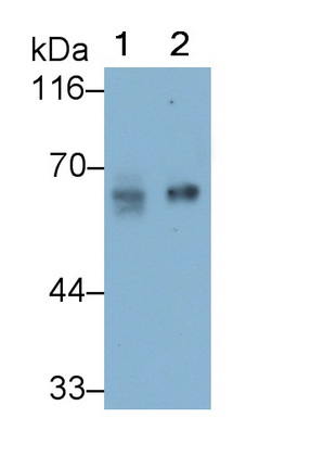 Monoclonal Antibody to Prosaposin (PSAP)