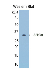 Monoclonal Antibody to Reelin (RELN)