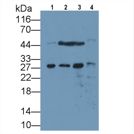 Monoclonal Antibody to Thymidine Kinase 1, Soluble (TK1)