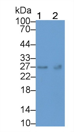 Monoclonal Antibody to Thymidine Kinase 1, Soluble (TK1)