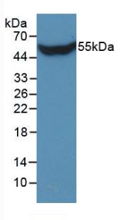 Monoclonal Antibody to Stanniocalcin 1 (STC1)