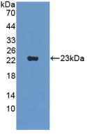 Monoclonal Antibody to Supervillin (SVIL)