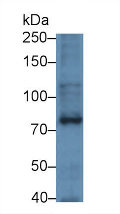 Monoclonal Antibody to Serotonin Transporter (SERT)