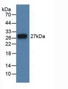 Monoclonal Antibody to Fibroblast Growth Factor 21 (FGF21)