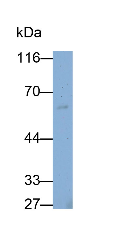 Monoclonal Antibody to Carcinoembryonic Antigen Related Cell Adhesion Molecule 1 (CEACAM1)