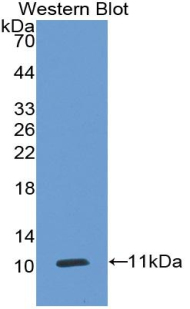 Monoclonal Antibody to Carcinoembryonic Antigen Related Cell Adhesion Molecule 7 (CEACAM7)