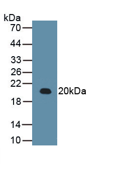 Monoclonal Antibody to Arginyl tRNA Synthetase (RARS)