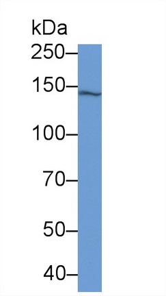 Monoclonal Antibody to Isoleucyl tRNA Synthetase (IARS)