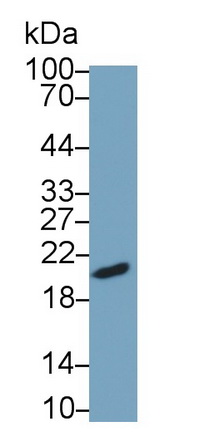 Monoclonal Antibody to Follicle Stimulating Hormone Beta (FSHb)