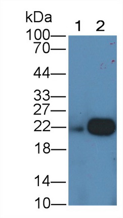 Monoclonal Antibody to Ferritin, Light Polypeptide (FTL)