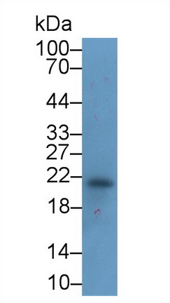 Monoclonal Antibody to Ferritin, Heavy Polypeptide (FTH)