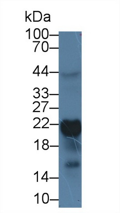 Monoclonal Antibody to Ferritin, Heavy Polypeptide (FTH)