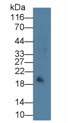 Monoclonal Antibody to Ferritin, Heavy Polypeptide (FTH)