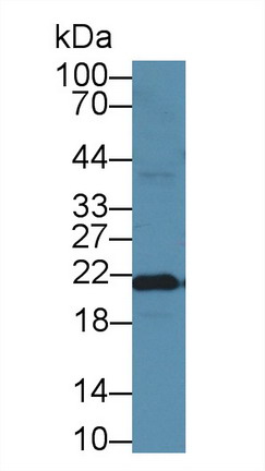 Monoclonal Antibody to Ferritin, Heavy Polypeptide (FTH)