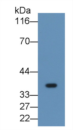 Monoclonal Antibody to Fibrinogen Like Protein 1 (FGL1)