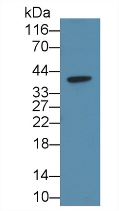 Monoclonal Antibody to Carbonic Anhydrase IV (CA4)