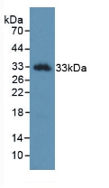 Monoclonal Antibody to Kallikrein 2 (KLK2)