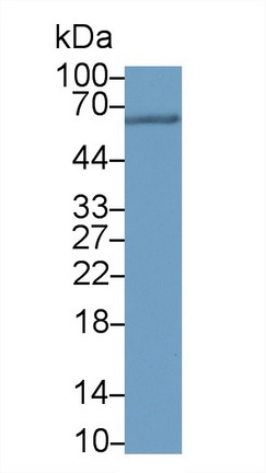 Monoclonal Antibody to Sequestosome 1 (SQSTM1)