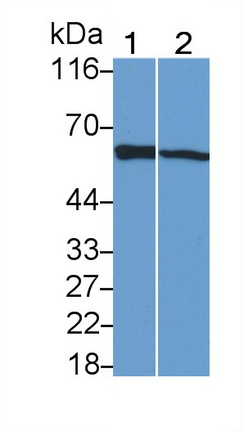 Monoclonal Antibody to Sequestosome 1 (SQSTM1)