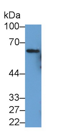 Monoclonal Antibody to Sequestosome 1 (SQSTM1)