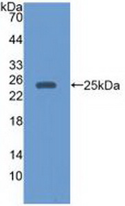 Monoclonal Antibody to Epstein Barr Virus Induced Protein 3 (EBI3)