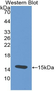 Monoclonal Antibody to Thyroid Stimulating Hormone Beta (TSHb)