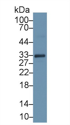 Monoclonal Antibody to Troponin T Type 2, Cardiac (TNNT2)