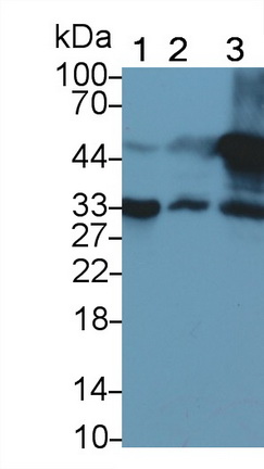 Monoclonal Antibody to Troponin T Type 2, Cardiac (TNNT2)