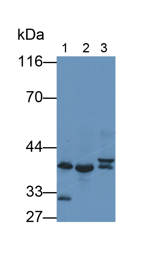 Monoclonal Antibody to Troponin T Type 2, Cardiac (TNNT2)